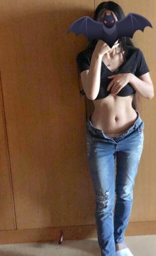 腰部超声溶脂好不好？上海洁铭案例在线一览