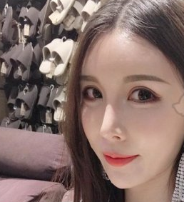 开外眼角果？北京世熙医疗美容案例分享