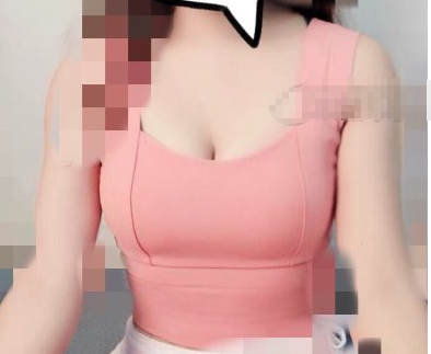 宋玉龙假体隆胸怎么样？北京世熙医美案例展示