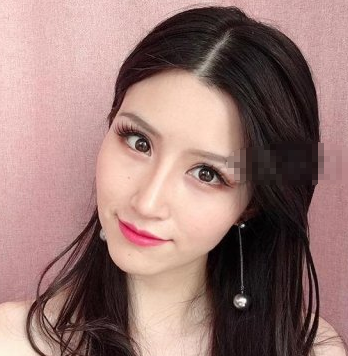 苏州小妹纸在康美张武医生做的鼻子果怎样?