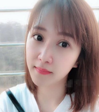 南宁寻美姐姐梦想整形美容注射瘦脸术后果分享