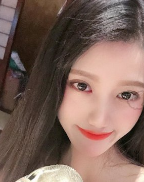 北京明德医院激光美肤激光术后83天果附对比图分享