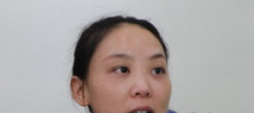 耳软骨隆鼻修复,北京亚楠容悦蒋亚楠医生案例