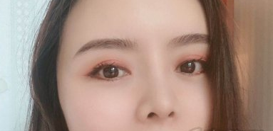 四川华美紫馨苏辰枫肋软骨隆鼻咋样?案例一览