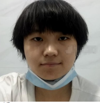 重庆珂琳雅医美王陈医生鼻部手术案例分享