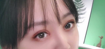 埋线双眼皮好不呢?广州妹纸宸山医美程宁医生