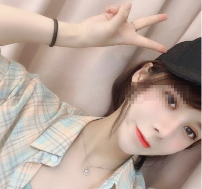 北京华悦府医生朱燕鼻部多项案例分享！