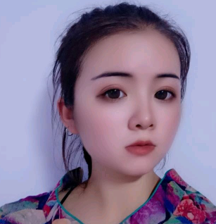 上海光博士医疗美容门诊部热玛吉案例!