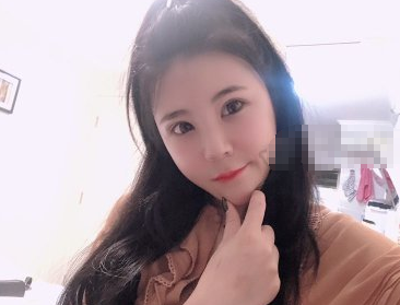 重庆艺星医疗美容医院自体脂肪全脸填充案例!