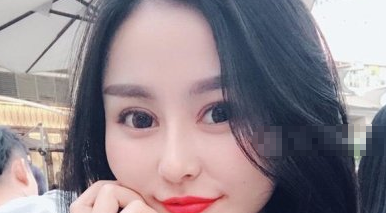 深圳阳光整形美容医院眼部多项案例分享!