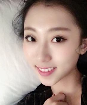 陕西西安美立方隆鼻果好吗 李旭平隆鼻案例