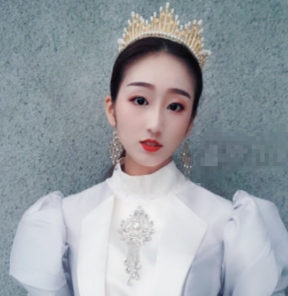 成都华美整形隆鼻好不好?隆鼻案例附图分享