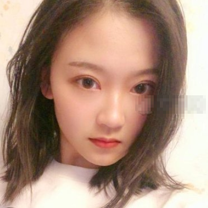 武汉柠悦医美割双眼皮好不好?有案例吗?