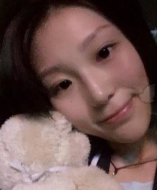 做鼻部手术好不好?武汉一美医疗美容汪利龙案例