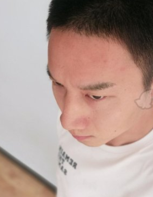 武汉欧尚美医疗美容怎样啊？假体丰额头果