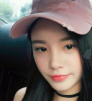 武汉新至美聂祝锋脂肪填充可靠吗?面填案例