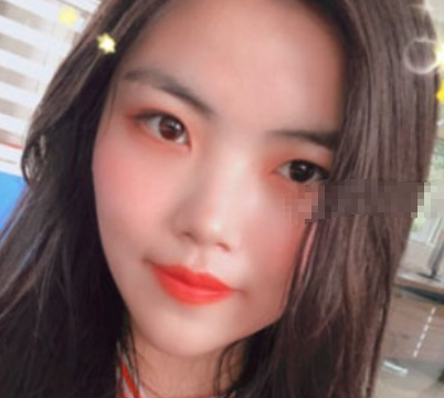 北京欧华医疗美容护肤好不好？光子嫩肤果