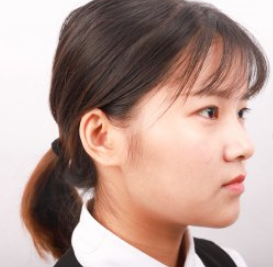 深圳妍熙医疗美容门诊部眼部修复案例分享!