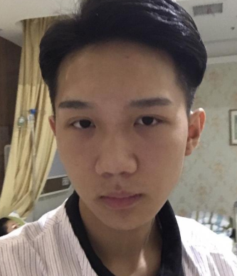 长沙协雅医疗美容邹笑寒鼻部手术案例分享!