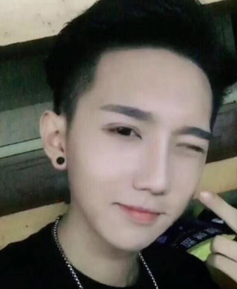 长沙协雅医疗美容邹笑寒鼻部手术案例分享!
