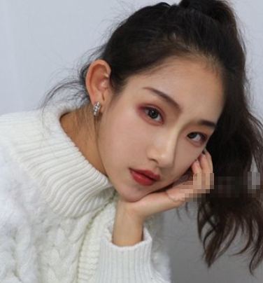 杭州美莱医疗美容医生韩超鼻部手术案例分享!