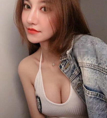 广州美莱李高峰假体隆胸咋样?案例附图分享