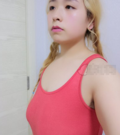 丰泽黄惠铭医疗美容自体脂肪隆胸案例分享!