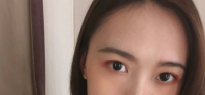 丰泽黄惠铭医美医院眼部手术案例分享!